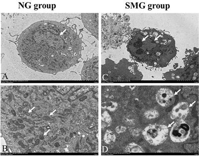 Effects of Simulated Microgravity on Ultrastructure and Apoptosis of Choroidal Vascular Endothelial Cells